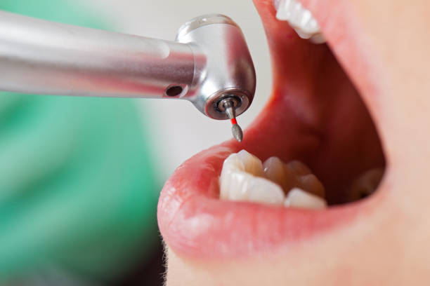 Best Knocked-Out Tooth Emergency  in Williamson, WV